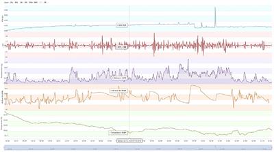 The Situation Specific Arousal Analyzer: Innovation in the Physiological Assessment of Foreign Language Education Anxiety